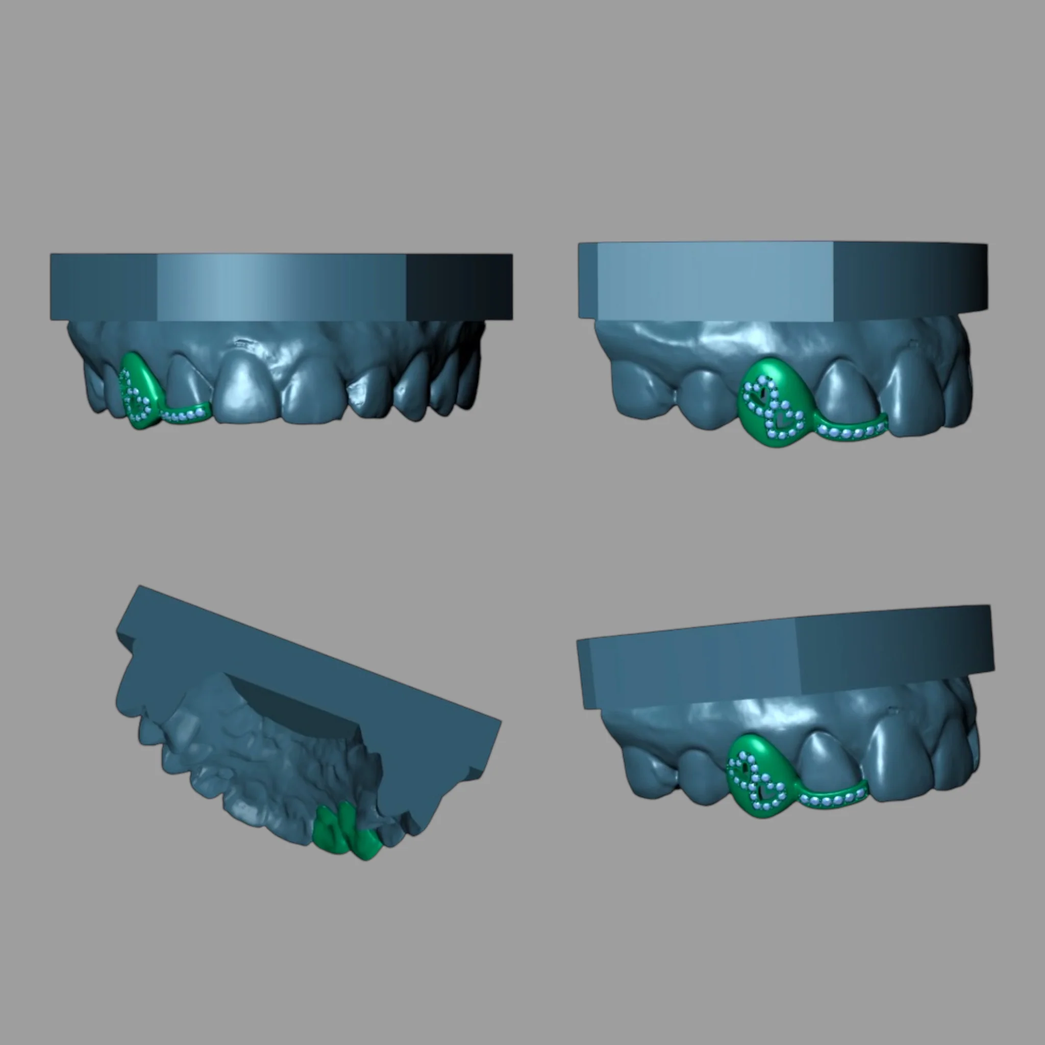 Thumbnail 2